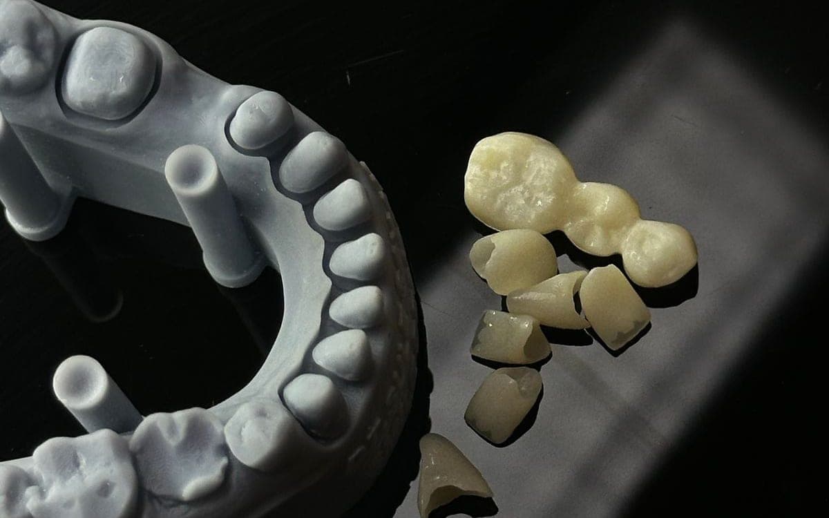 Destek çubukları olan, 3D baskıyla üretilmiş gri çene modeli ve yanında küçük diş restorasyonları