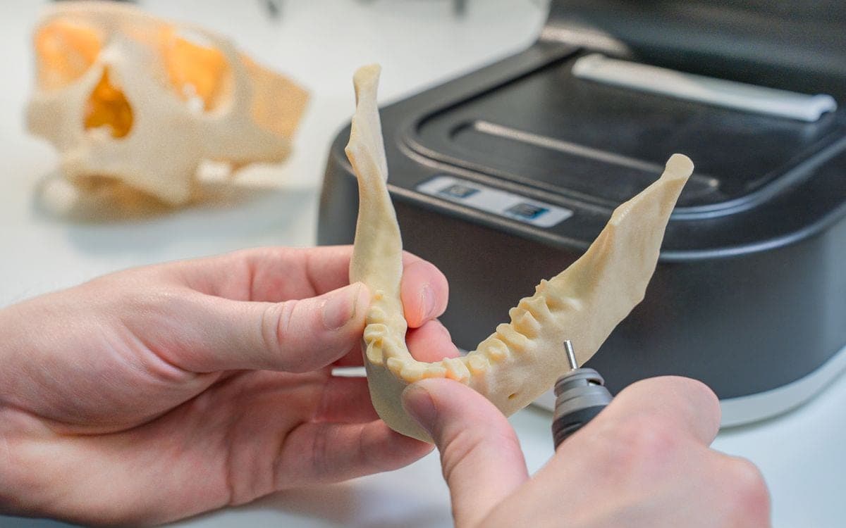Bir 3D yazıcının önünde, eldeki küçük bir aletle işlenen çene modeli